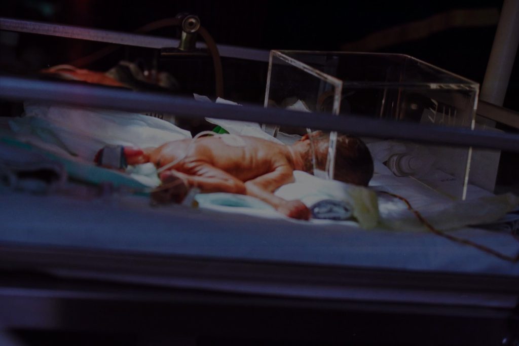Bambino prematuro in una incubatrice