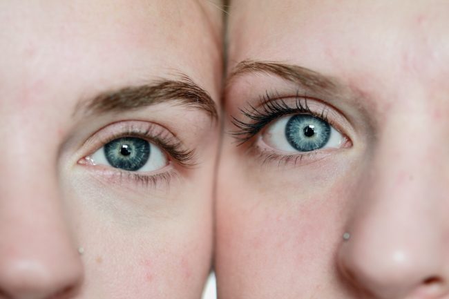 foto di due gemelle con occhi azzurri con la testa appoggiata lateralmente fra di loro in cui si vedono solo due occhi: uno per ognuna di loro. Nei casi di sindrome da gemello scomparso si tende a vivere una vita divisa a metà e lo si vede nelle costellazioni familiari